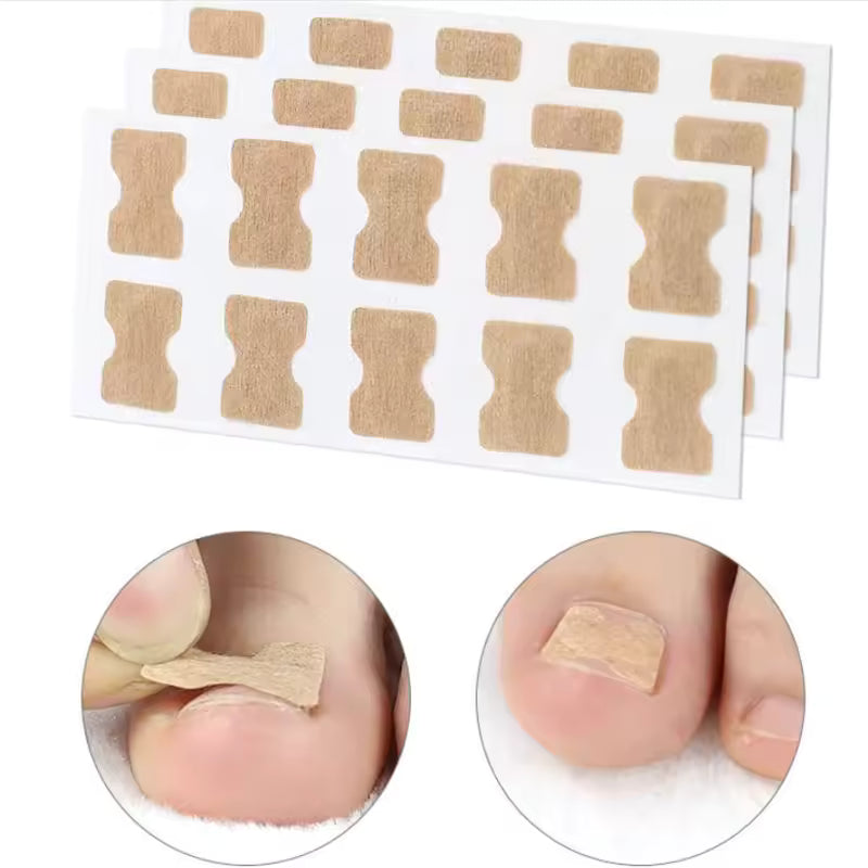Toenail Correction Strips SET