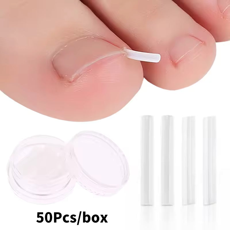 Toenail Correction Strips SET