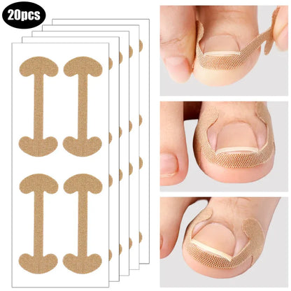 Toenail Correction Strips SET